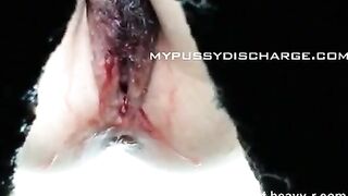 Bloody Piss And Shit In Public Toilet On Cam