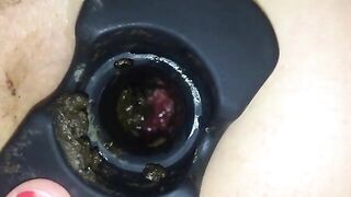 Asshole and poop closeup
