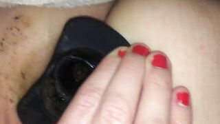 Asshole and poop closeup