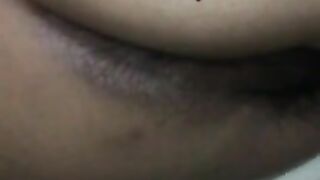 Diarrhea leaking poop