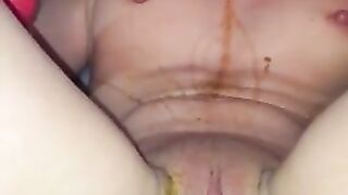 Trying to poop on her own sweet face