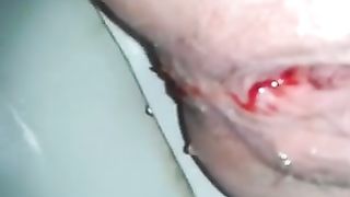 menstrual shitting filmed up close
