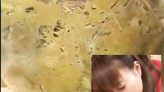 Asian girl with shitty ass gets colonoscopic test