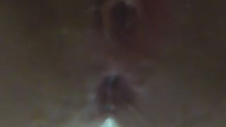 Wet and stinky diarrhea