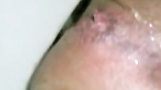 Soft Creamy Diarrhea