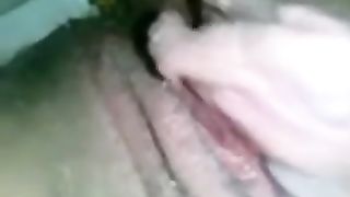 Soft Creamy Diarrhea