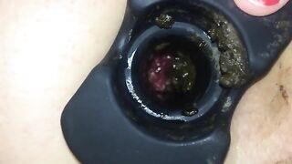 Struggling with the butt plug dildo