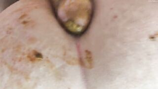 Dirty poop covered cock banging asshole
