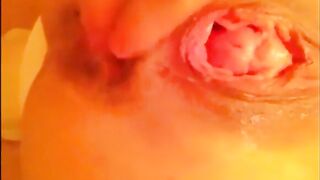 Anal self fisting prolapsed solo