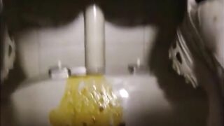 Leaking a big squirt of diarrhea