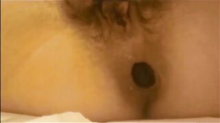 Hairy pussy milf shitting a load of diarrhea