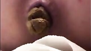 Beautiful hard poop closeup