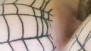 Chick covered in a fishnet stocking gets her asshole stitched