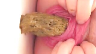 Prolapsed anus milf shitting and fingering