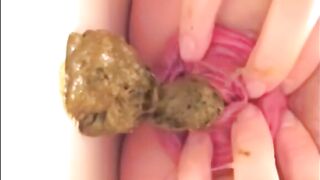 Prolapsed anus milf shitting and fingering