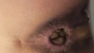 Gorgeous pooping asshole hot closeup