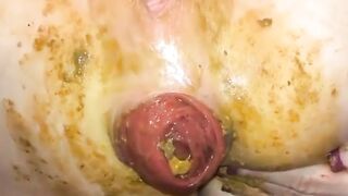 Dirty messy asshole poop