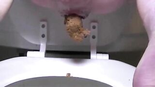 Dirty closeup of hard poop in toilet