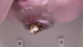 Dirty closeup of hard poop in toilet