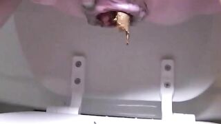 Dirty closeup of hard poop in toilet