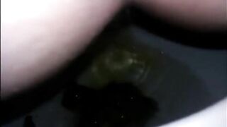 Shitting diarrhea in the toilet closeup