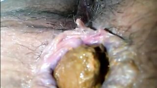 Hairy lovely woman asshole and cunt shitting closeup