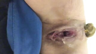 Massive hard turd from tight ass