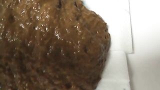 Wet soft poop closeup