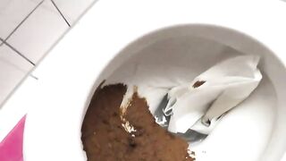 Pee and poop closeup