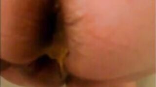 Mature lady shitting diarrhea closeup