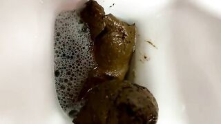 Really wide stretch of her asshole