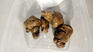 Hard thick poop in plastic