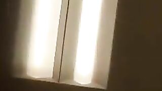 Leaking shit asshole