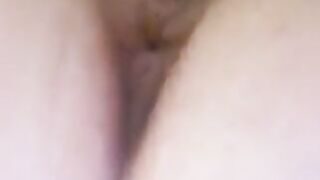 Leaking shit asshole