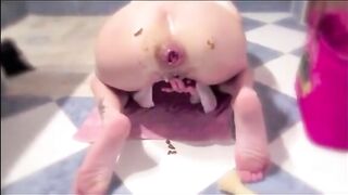 Girl prolapsed asshole plug fart and shit