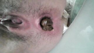 Heavy hard turd in closeup