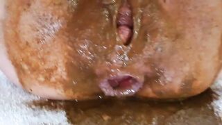 Dirty asshole covered in massive shit