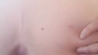 Candy And Poop Closeup