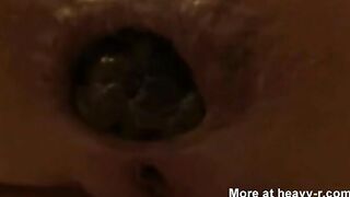 Amazing green turd closeup