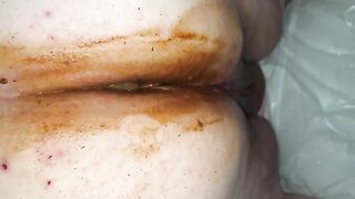 Girl spreads her pussy lips and shows her shit stained asshole