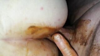 Girl spreads her pussy lips and shows her shit stained asshole