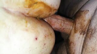 Girl spreads her pussy lips and shows her shit stained asshole