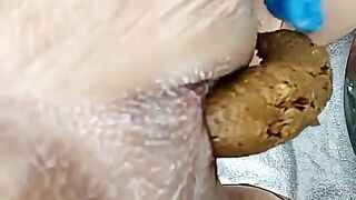 HD poop and asshole