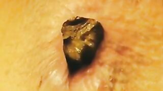 Lovely shit bits closeup