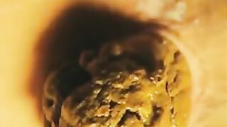 Lovely shit bits closeup