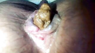 Close up of mature woman pooping
