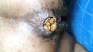 Shit comes out of an asshole
