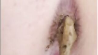 Woman digs in her asshole and pulls out a huge load of shit