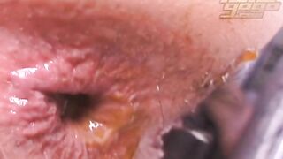 Huge load of shit by cute japanese girl