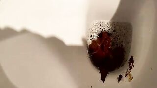 Huge poop viewed close up 